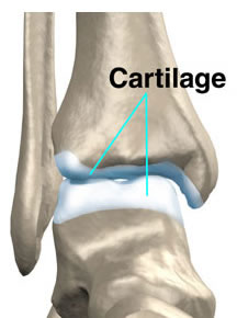 Cartilagem Articular