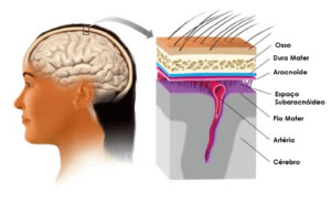 Calota Craniana e Meninges