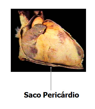 Coração com Saco Pericárdio