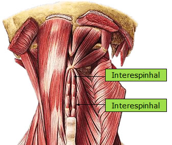 Músculo Interespinhal