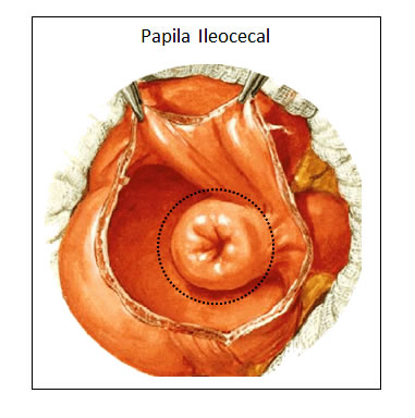 Válvula Ileocecal 