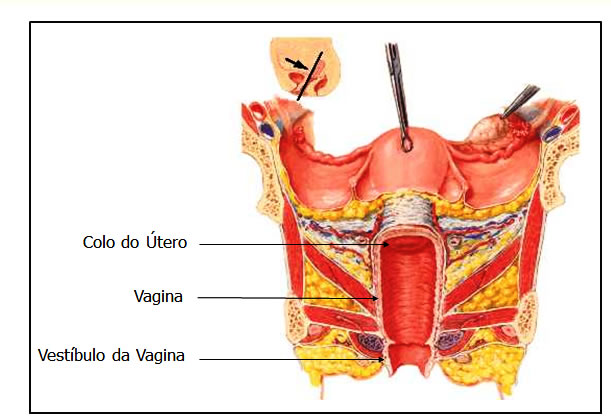 Canal da Vagina