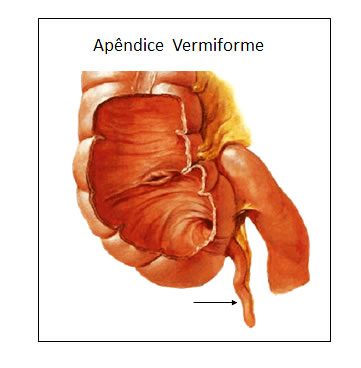 Apêndice Vermiforme