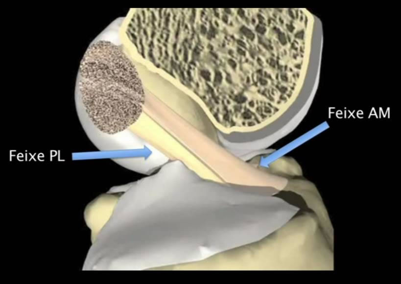 Bandas do Ligamento Cruzado Anterior