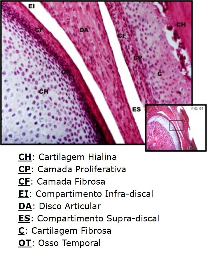 TMJ Hyaline Cartilage