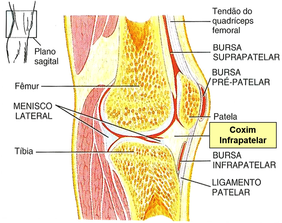 Coxim Infrapatelar