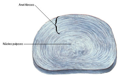 Disco Intervertebral