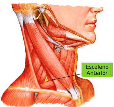 Músculo escaleno anterior