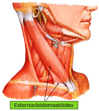 Músculo Esternocleidomastoideo