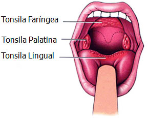 Tonsilas Palatinas - Tonsila Faríngea