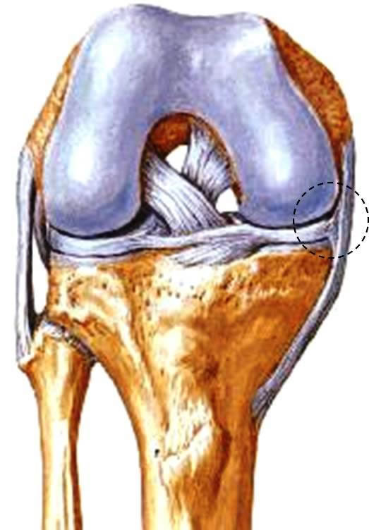 Ligamento Colateral Tibial