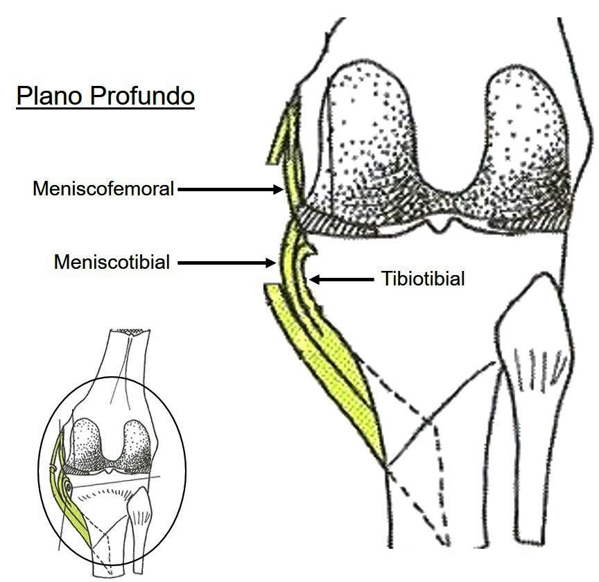 Ligamento Colateral Tibial - Plano Profundo