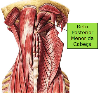 Músculo Reto Posterior Maior da Cabeça