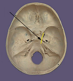 Nervo Oculomotor - Passagem