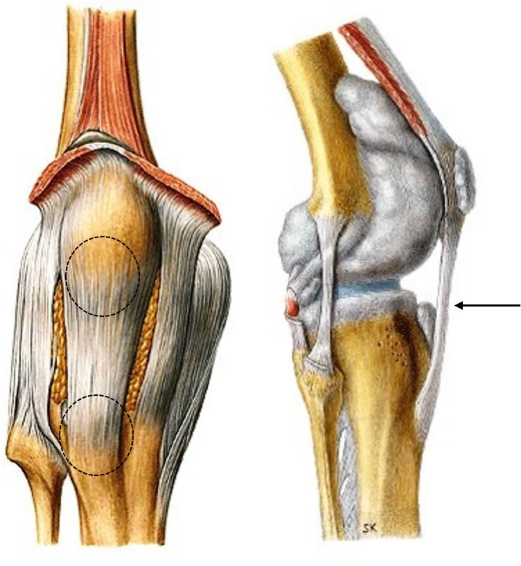 Ligamento Patelar