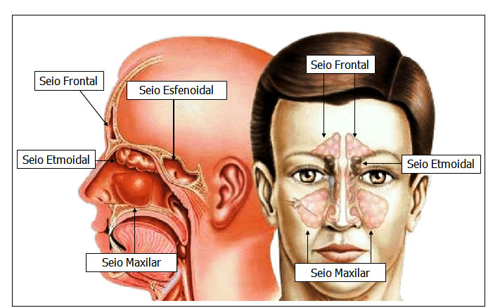 Seios Paranasais ou Seios da Face - Vistas Lateral e Anterior