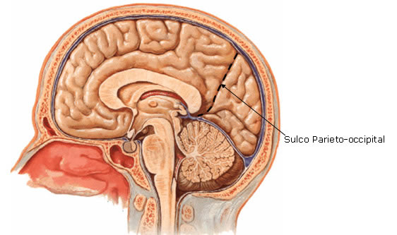 Hemisfério Cerebral - Vista Medial - Sulco Parieto-occipital