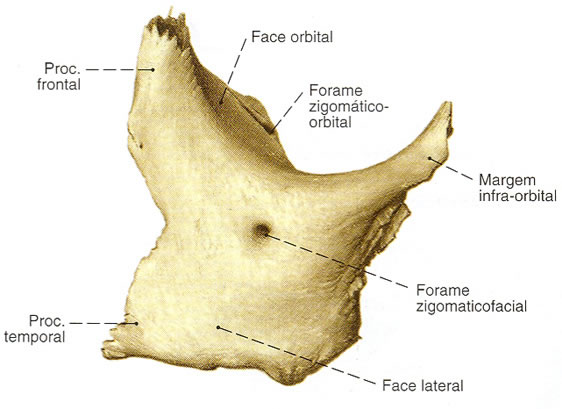 Osso Zigomático - Vista Lateral